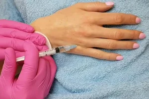 Биоревитализация кожи кистей рук: Восстановление молодости и красоты