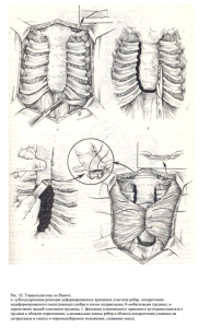 Деформация грудной клетки: современные технологии в помощь пациентам