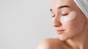 Как избавиться от постакне: эффективные методы и рекомендации