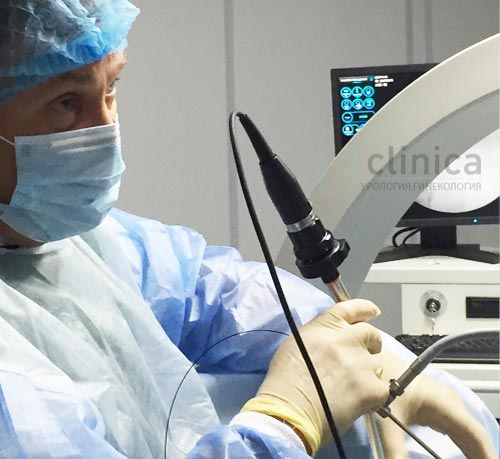 С чего начать лечение камней в почках