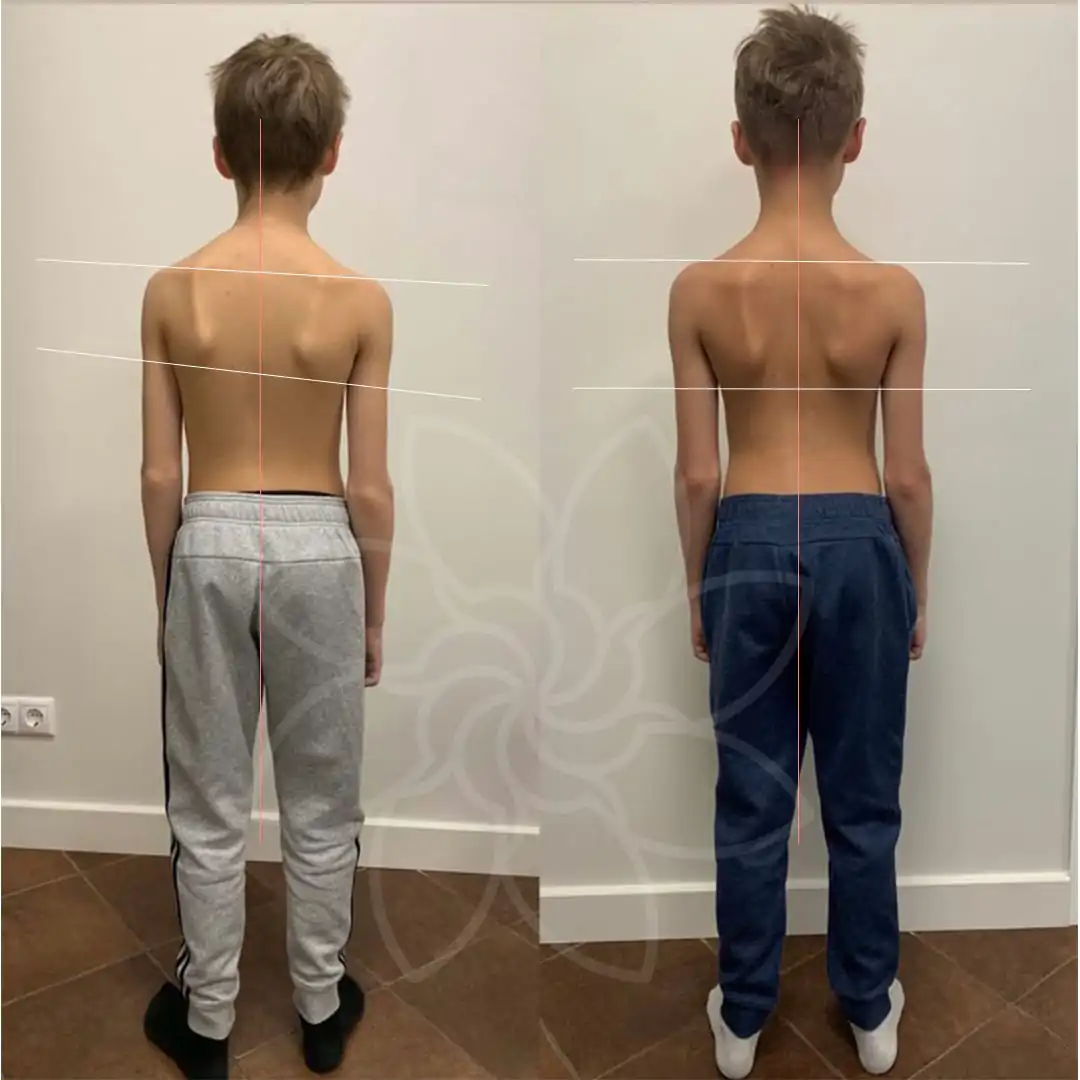 Почему стоит обратиться к остеопату: преимущества и показания